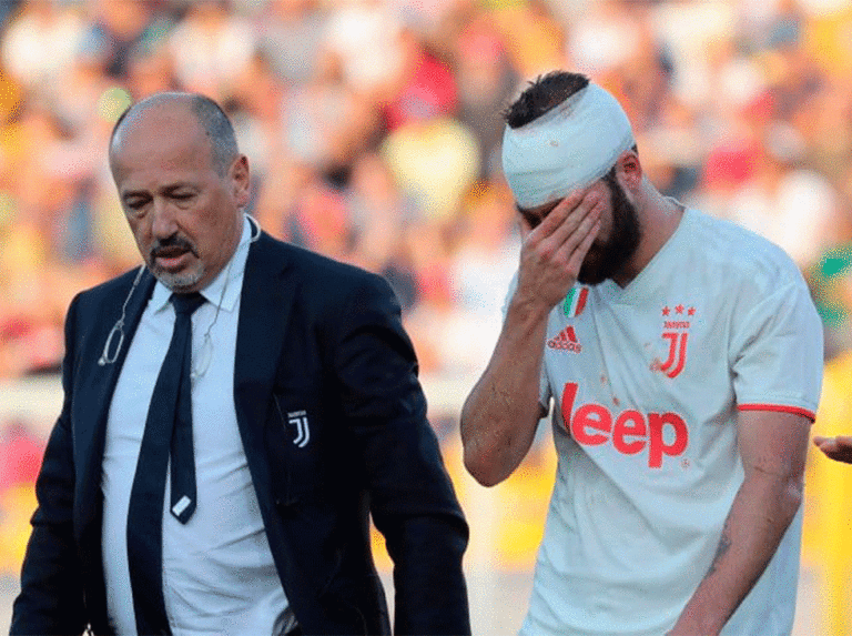 Higuaín no se recupera del golpe en la cabeza y se pierde Juventus-Genoa