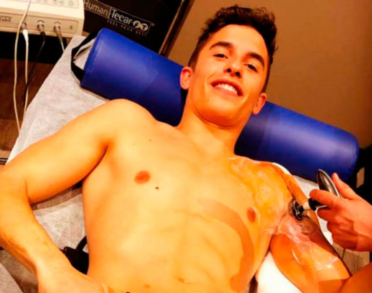 Márquez será operado del hombro